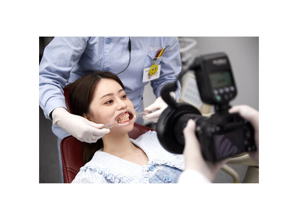 Godox MF-R76S+ Dental Macro Ring Flash for Dental Photography for Sony 